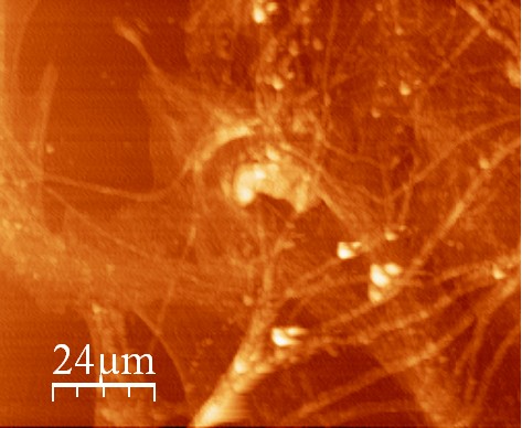 Neuron